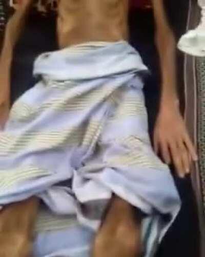 That’s Yemen, however you don’t hear much about it in the news. The war in Yemen will only be taught in history classes and how wrong we were. History seems to repeat itself.