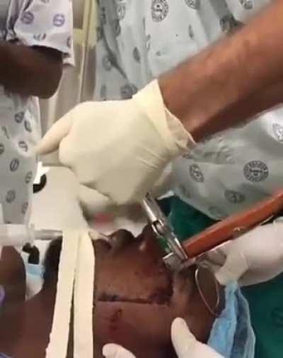 HMFT after I Get this Knife out my Eye!!