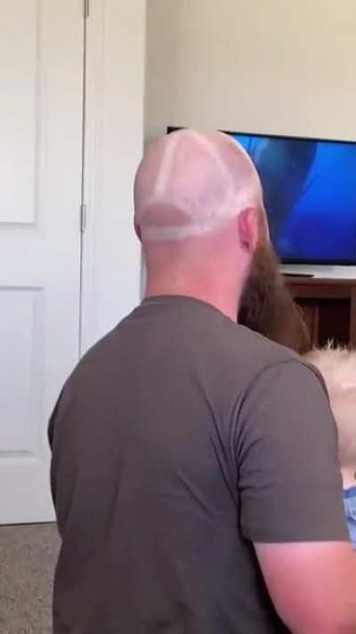 Bald head, mesh hat, no sunblock. WCGW?