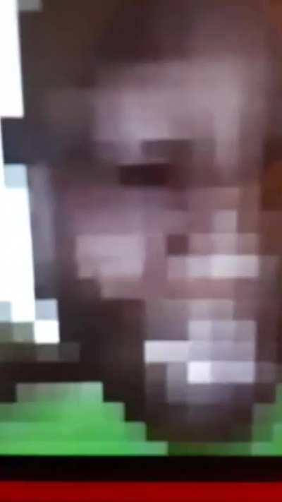 You nervous system after slam elbow on desk