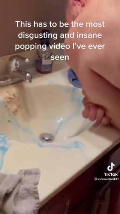 Absolutely disgusting cyst on dudes arm being popped