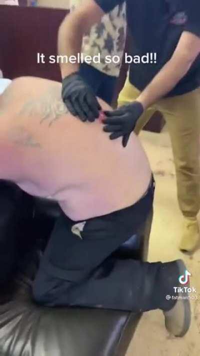 What I was hoping to see when Drew was checking out Potter's cyst