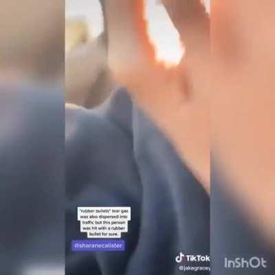 Police shooting at innocent civilians, again.