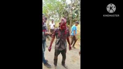 Man survives after multiple Tiger attacks smash his head