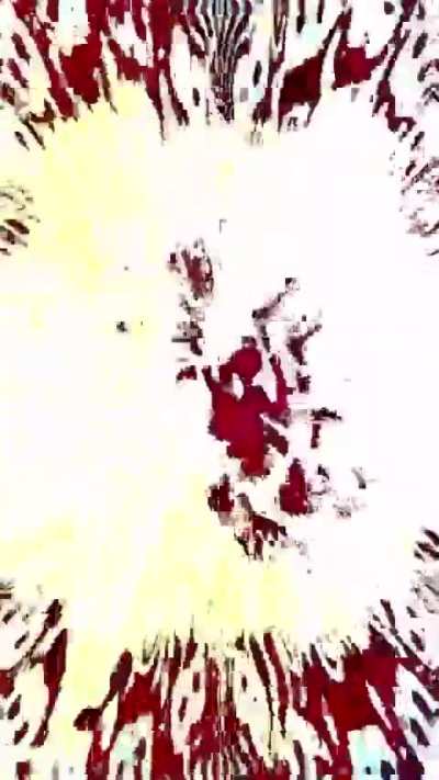 Get lobotomised for free today