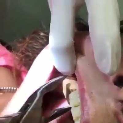 An extreme case of calculus