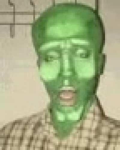 just got diagnosed with type 3 diabete