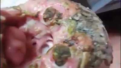 A Vietnamese man with a mysterious flesh-eating disease that baffles doctors.