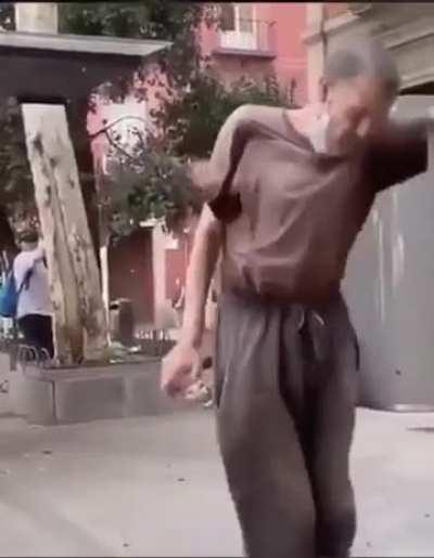 Man looked like he had riggity rickets.