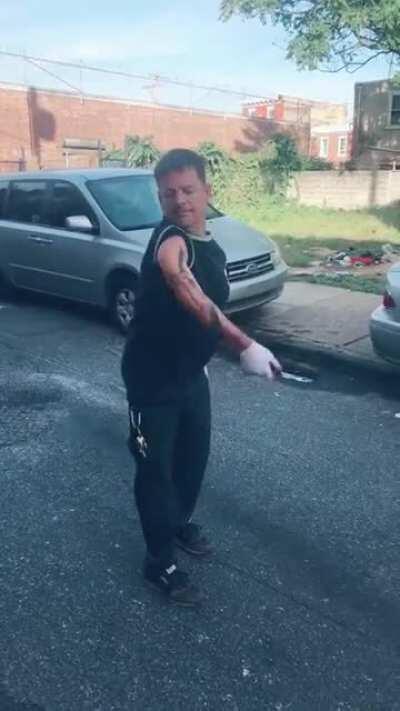 What happened to Michael J Fox's arm?