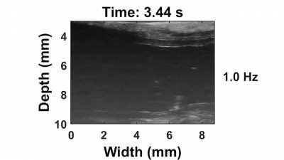 Боитесь чипизации? Не беспокойтесь! Скоро ваш чип придёт к вам вам, и проникнет в вас через прямую кишку.