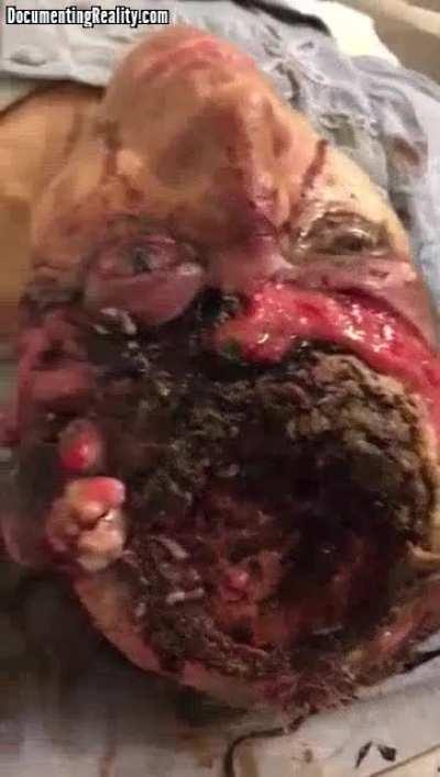 [NSFW] How would a medical team go about treating this woman?