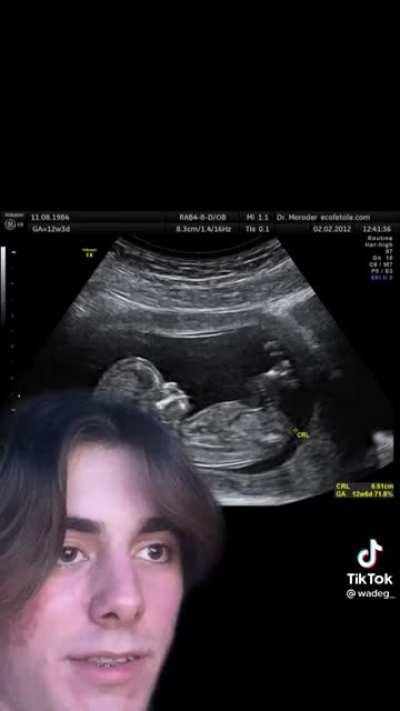 Found on r/tiktokcringe. This is legit what they sound like though 😟