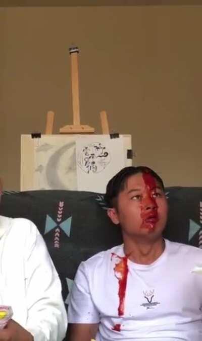 This fries need some ketchup!