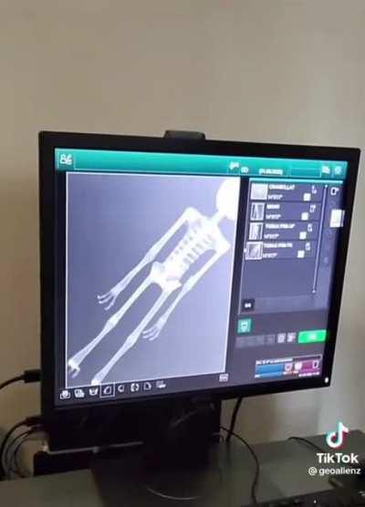 what is your opinion on these bodies?