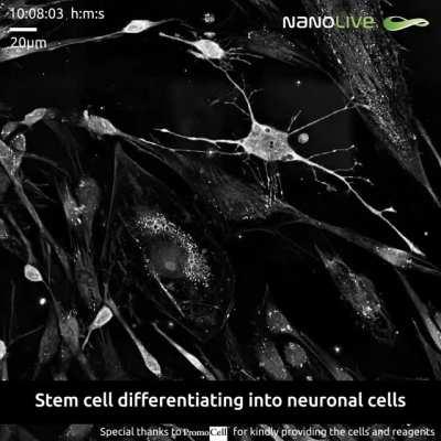 Birth or a Neuron (stem cell differentiates into a neuron like cell)