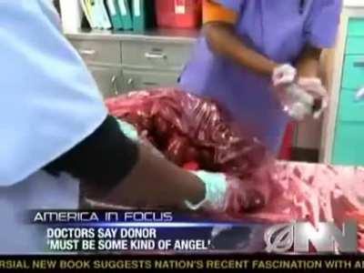 Anonymous hero donates 200 human kidneys to hospital!