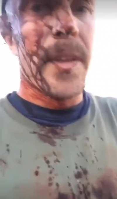 man mauled by bear is chill af.