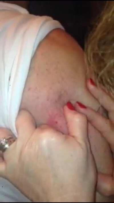 Ah yes, get projectile vomited on by an arm