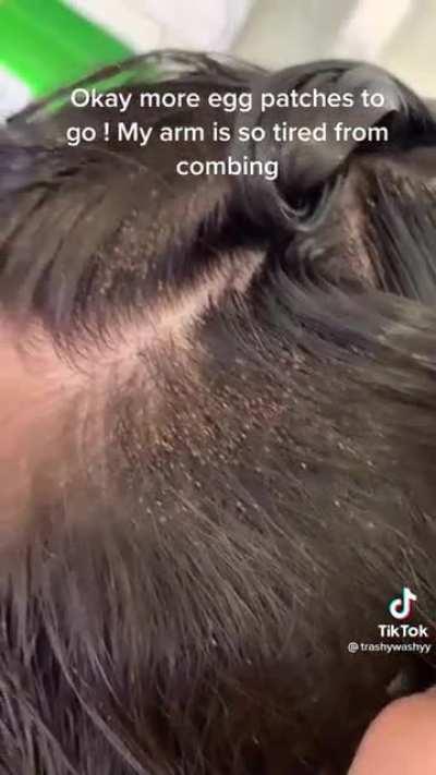 I'd just decapitate myself.