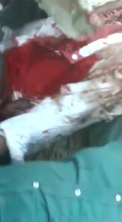 Horrible Car Accident, you can see his heart beating