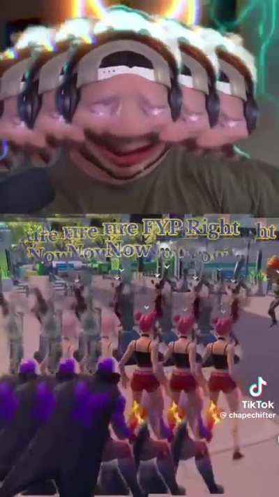 Let's be for real. His neck hurts.