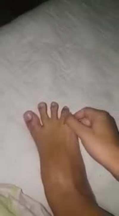 Cursed_little_toe