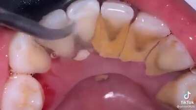 How long does it take to get this?