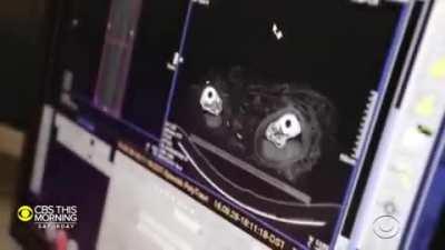 Scientists have recreated the sound this ancient mummy's vocal chords would have made