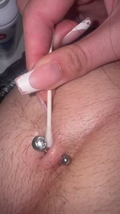 Red ball of something on my belly button piercing?