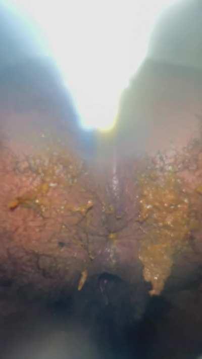 Your pov sitting under my fat messy hairy wet Black BBW ass when I have the runs