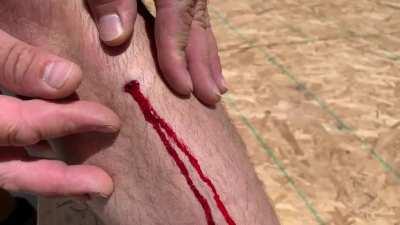 Just a small hole. Fell from a ladder into a crawl space. I was very luck.