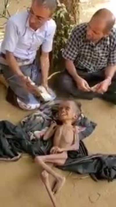 Attacks across Yemen causing mass poverty starvation & death. This is racism. This is child abuse.