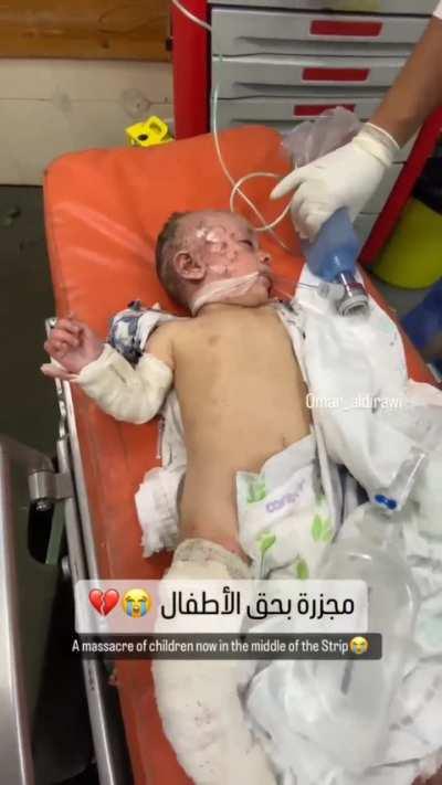 Arrival of another infant to the hospital after being injured in the israeli occupation airstrikes on Gaza