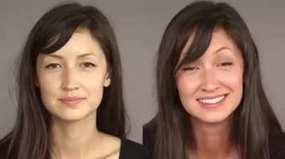 Alcohol flush reaction , Also known as 