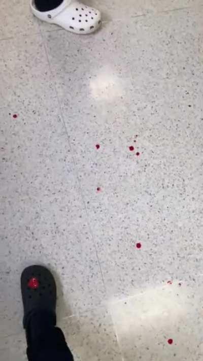 Deo who won (this is not me )