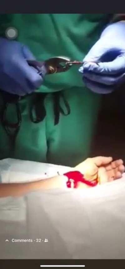 Nail gun mishap leads to ER visit