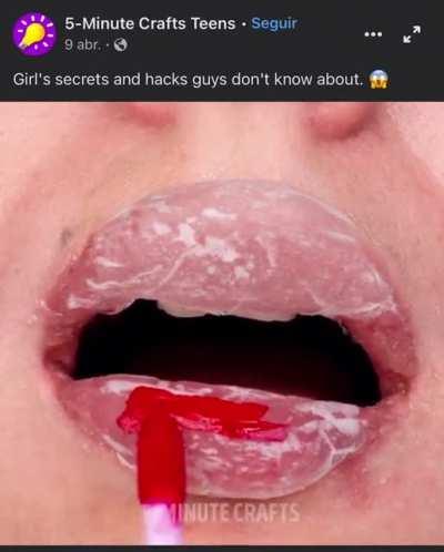 Why get fillers when you can just put hair wax? (Btw this is aimed at TEENS)