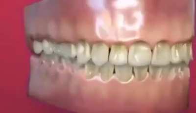 Hey wake up. Teeth breathing is back 