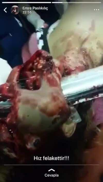 Kafasına tampon giren eleman