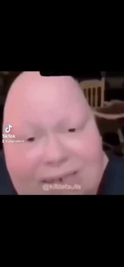 Humpty Dumpty fr fr 💀🔥