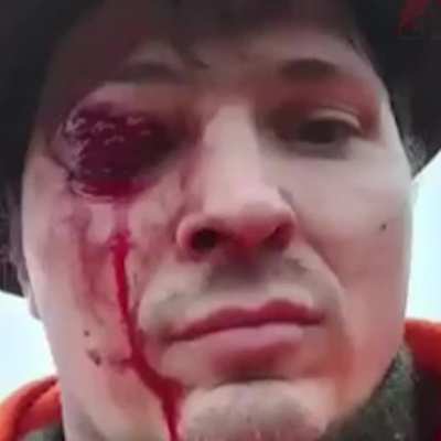 Hunter got hunted by a deer