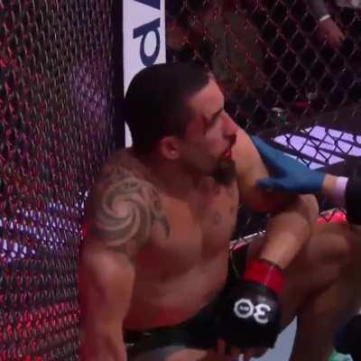 sorry for underestimate