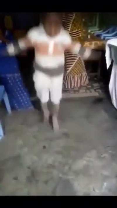 surya dancing after removing kidney stones be like: