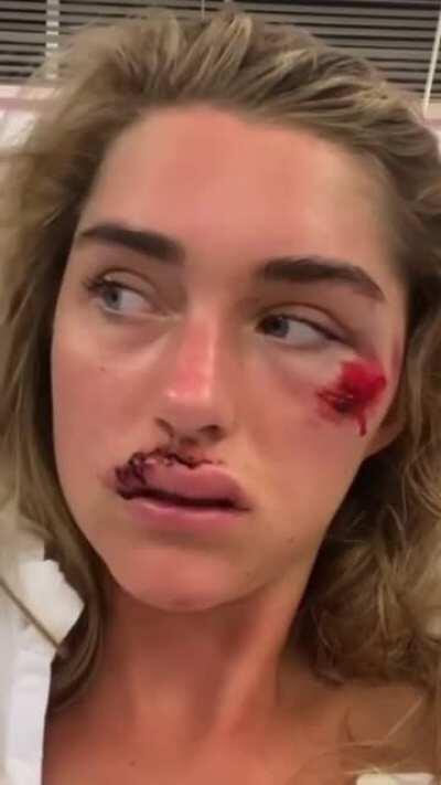 HMFT after I bomb this hill