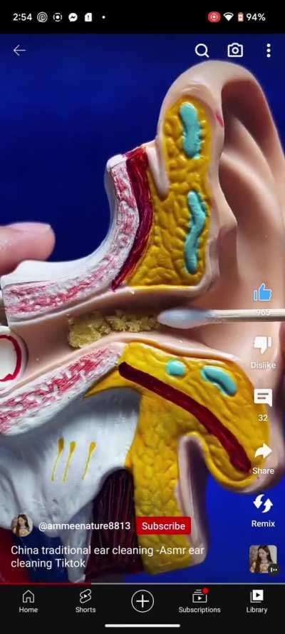 Chinese Ear Cleaning 