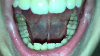 Gleeking in slow motion (re-upload)