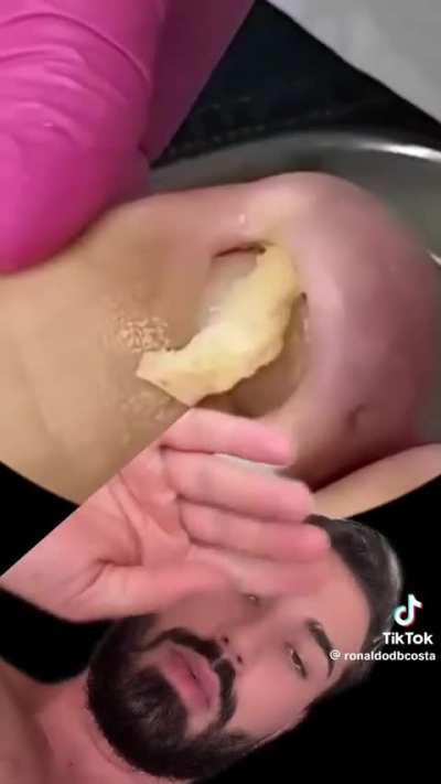 Nail