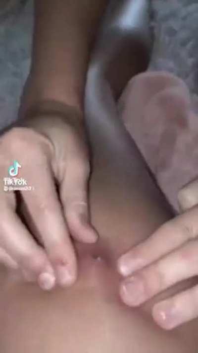 Pimmple popping 😋