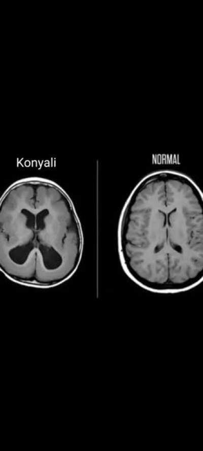 Abi neden oyle dedin ua 😿😿
